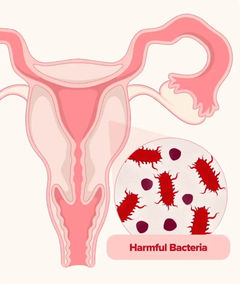 URO Vaginal Probiotics for Odor